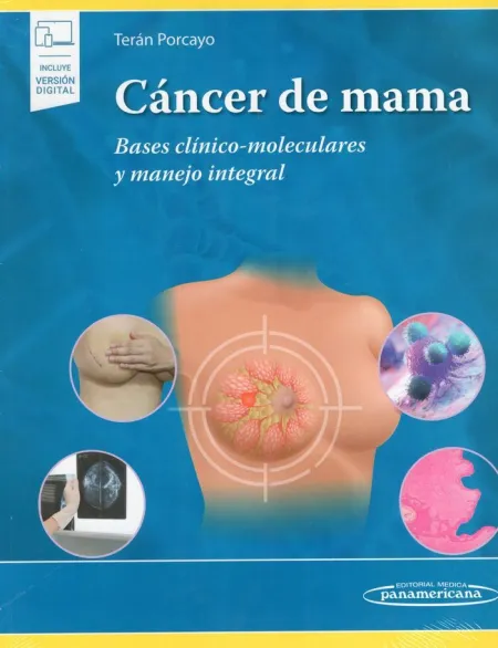 Cáncer de Mama