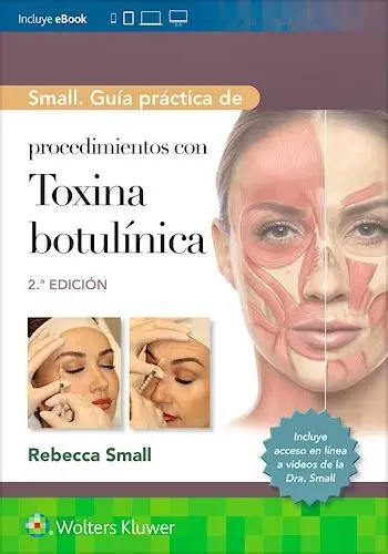 Small. Guia Practica Prodecimientos con Toxina Botulinica