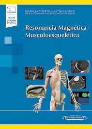 Resonancia Magnetica Musculoesqueletica