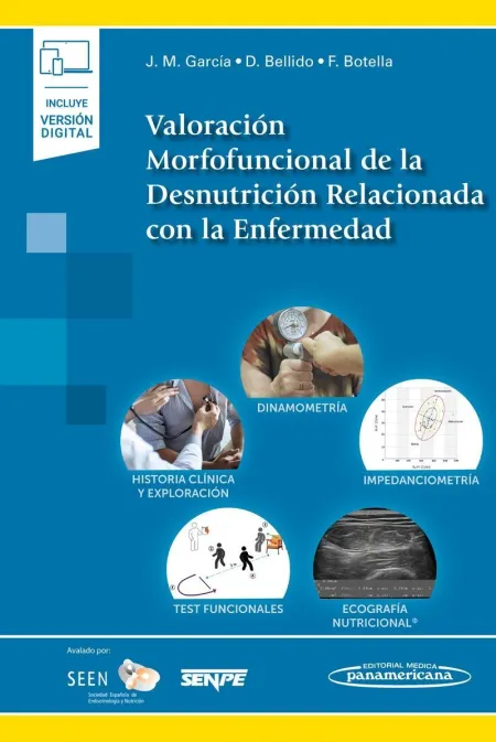 Valoración Morfofuncional de la Desnutrición Relacionada con la Enfermedad con la Enfermedad