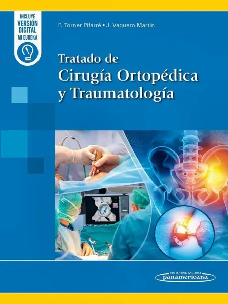 Tratado Cirugia Ortopedica y Traumatologia