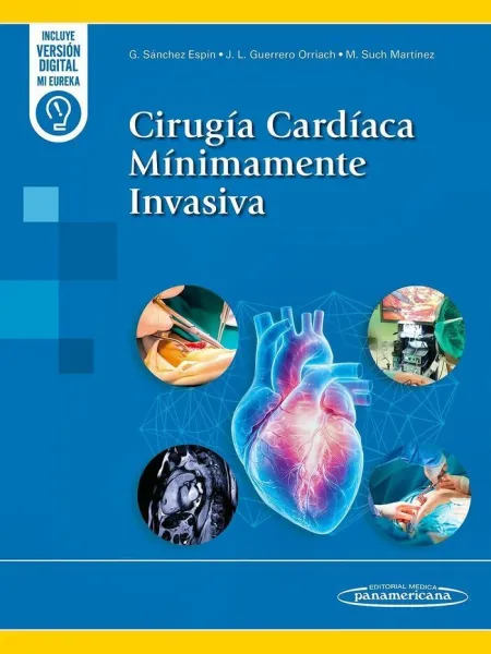 Cirugía Cardíaca Mínimamente Invasiva
