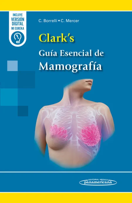 Clark´s Guia Esencial de Mamografia