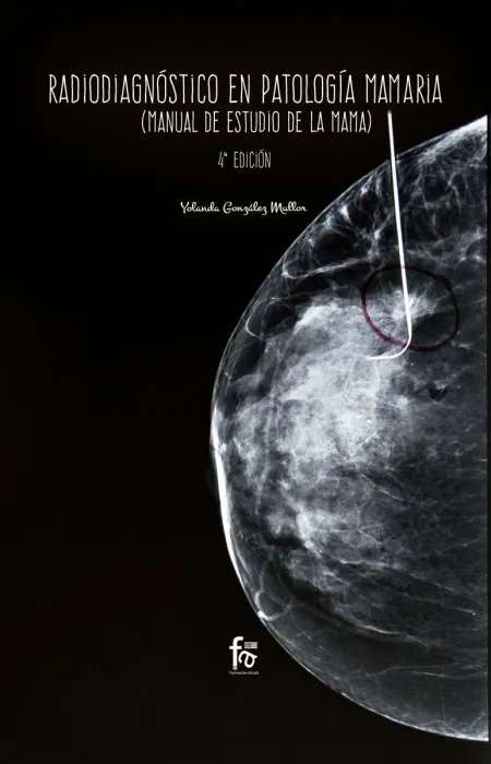 Radiodiagnostico en Patologia Mamaria (Manual de Estudio de la Mama)