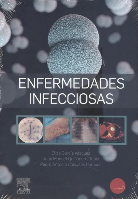 Enfermedades Infecciosas