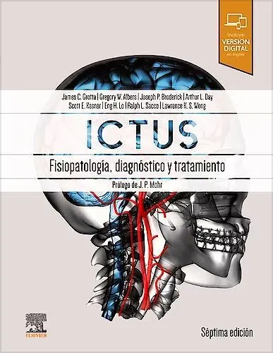 Ictus: Fisiopatología, Diagnóstico y Abordaje