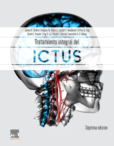 Tratamiento Integral del Ictus.