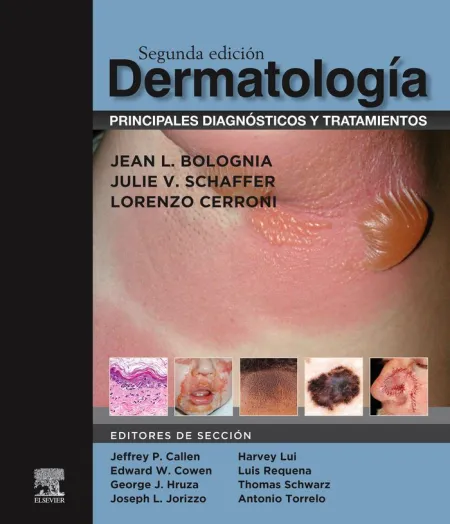 Dermatología: Principales Diagnósticos y Tratamientos (2ª Ed. )