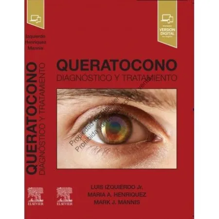 Queratoconon. Diagnóstico y Tratamiento