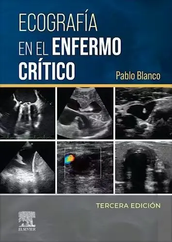 Ecografía en el Enfermo Crítico + Acceso Web