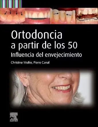 Ortodoncia a Partir de los 50