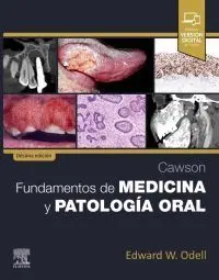 Fundamentos de Medicina y Patologia Oral. Cawson