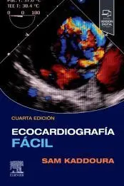 Ecocardiografia Facil