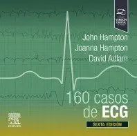 160 Casos de Ecg