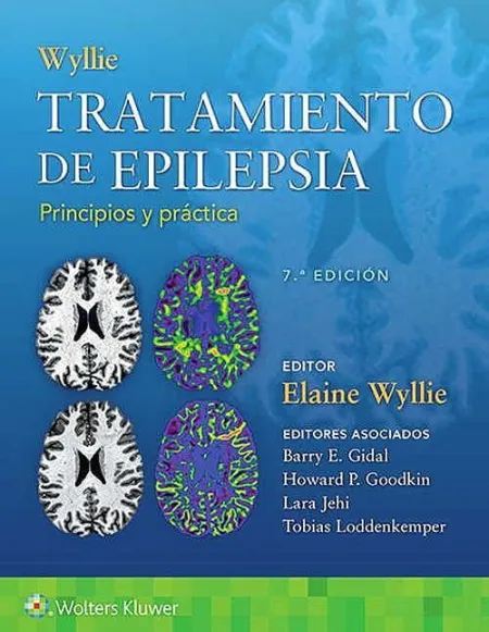 Tratamiento de Epilepsia: Principios y Práctica