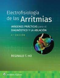 ELECTROFISIOLOGÍA DE LAS ARRITMIAS