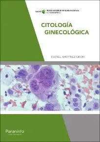 Citología Ginecológica