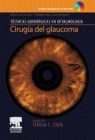 CIRUGIA DEL GLAUCOMA - TECNICAS QUIRURGICAS EN OFTALMOLOGIA