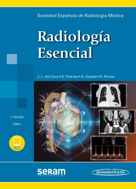 Radiologia Esencial (2 Vol. )