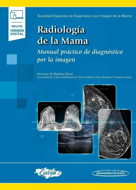 Radiología de la Mama(+Ebook)