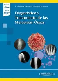 Diagnostico y Tratamiento de las Metastasis Oseas (Incluye Version Digital)