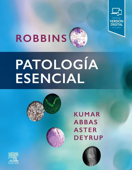 Patologia Esencial. Robbins