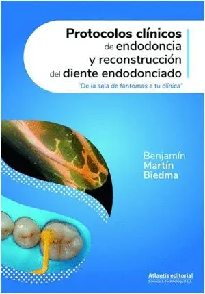Protocolos Clínicos de Endodoncia y Reconstrucción del Diente Endodonciado