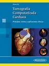 Tomografia Computarizada Cardiaca