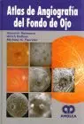 Atlas de Angiografia del Fondo de Ojo