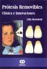Protesis Removibles Clasica e Innovaciones