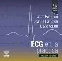 Ecg en la Práctica