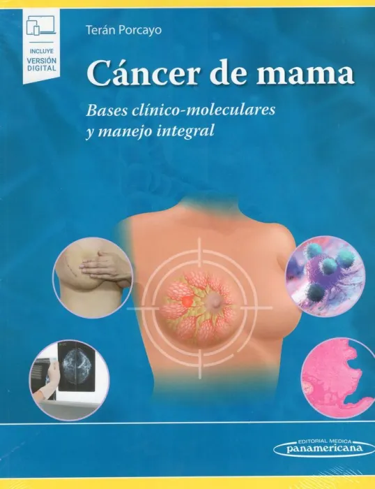 Cáncer de Mama