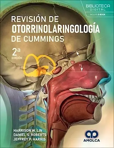 Revisión de Otorrinolaringología de Cummings