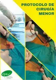 Protocolo de Cirugía Menor Ambulatoria para Atención Primaria