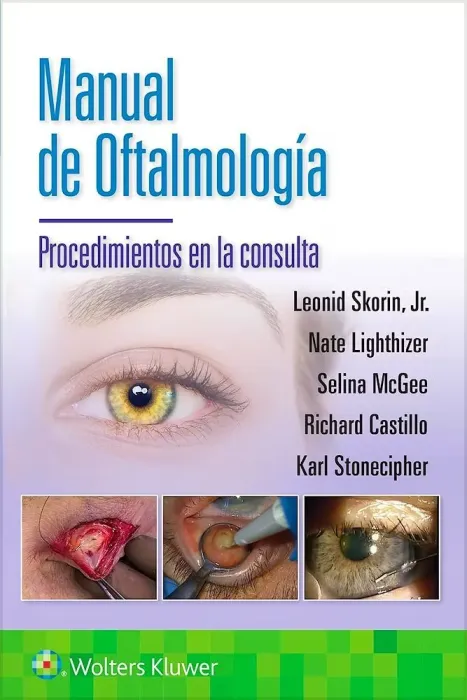 Manual de Oftalmologia. Procedimientos en la Consulta