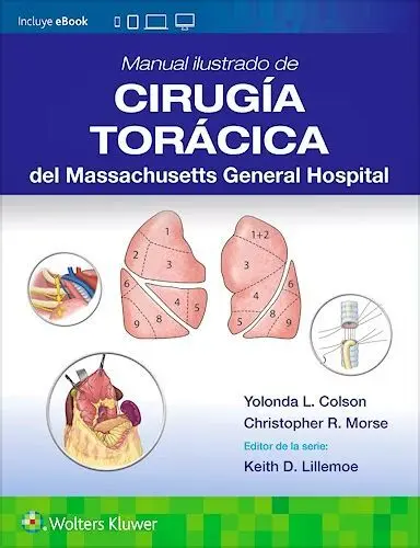 Manual Ilustrado de Cirugia Torácica del Massachusetts General Hospital
