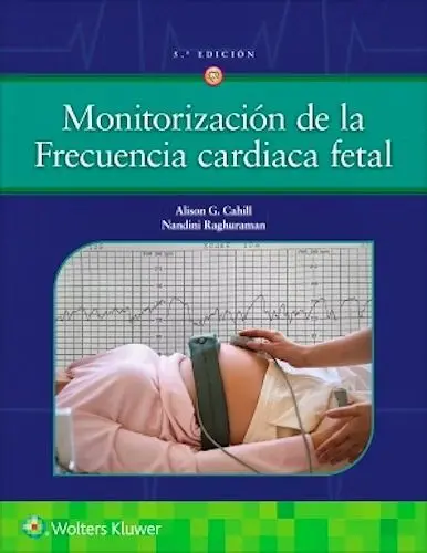 Monitorización de la Frecuencia Cardiaca Fetal