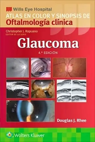 Glaucoma. Atlas en Color y Sinopsis de Oftalmologia Clinica. Wills Eye Hospital