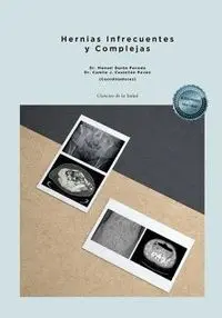 Hernias Infrecuentes y Complejas