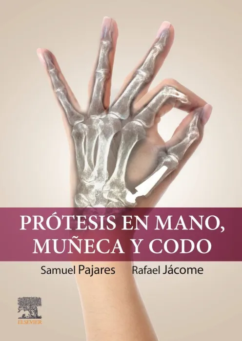 Protesis en Mano, Muñeca y Codo