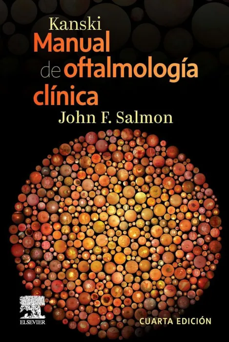 Kanski. Manual de Oftalmologia Clinica