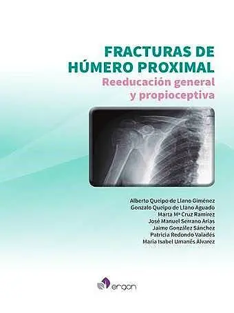 Fracturas de Húmero Proximal. Reeducación General y Propioceptiva