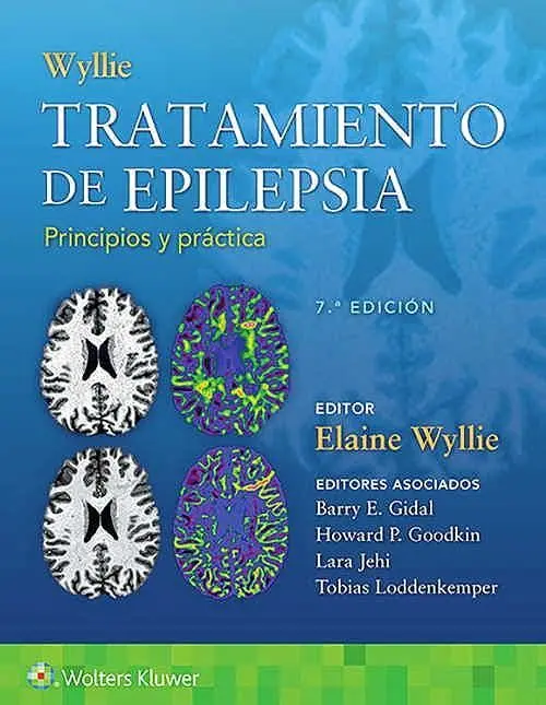 Tratamiento de Epilepsia: Principios y Práctica
