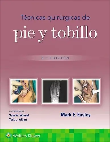 Tecnicas Quirúrgicas de Pié y Tobillo