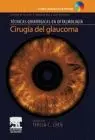 Cirugia del Glaucoma - Tecnicas Quirurgicas en Oftalmologia
