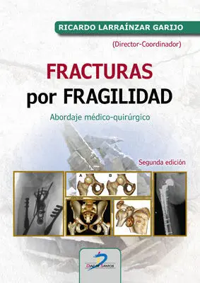 Fracturas por Fragilidad. Abordaje Medico Quirurgico