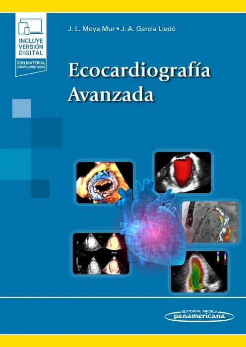 Ecocardiografia Avanzada