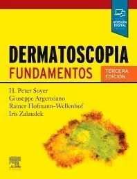 Dermatoscopia. Fundamentos