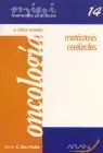 Metastasis Cerebrales