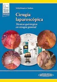 Cirugia Laparoscopica